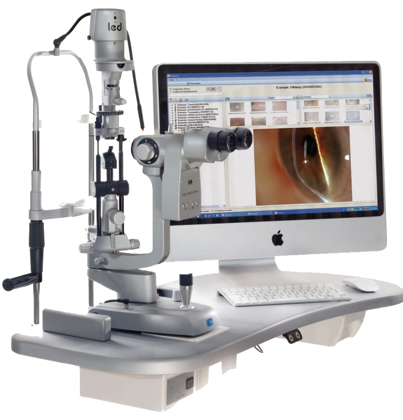 large 1364214029 SL990 digital CSO slit lamp min